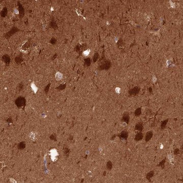 Anti-PPP3R1 antibody produced in rabbit