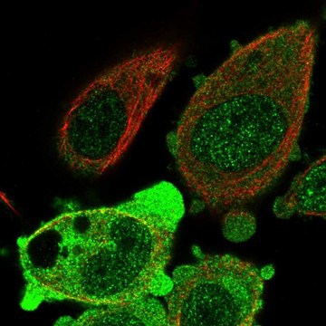 Anti-ANKRD36 antibody produced in rabbit