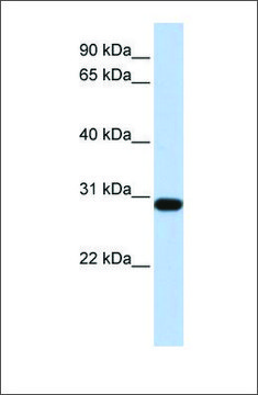 Anti-BPGM (ab2) antibody produced in