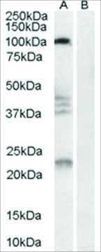 Anti-NOGO 66 Receptor antibody produced