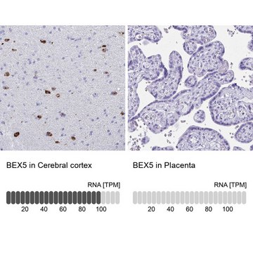 Anti-BEX5 antibody produced in rabbit