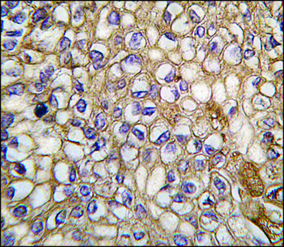 Anti-ALOX5AP (C-term) antibody produced in
