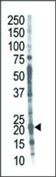 Anti-CROC1A (C-term) antibody produced in