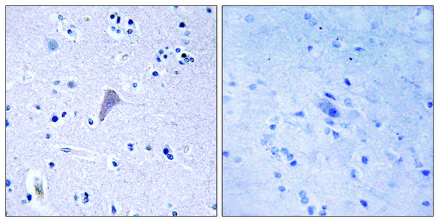 Anti-MTOR antibody produced in rabbit