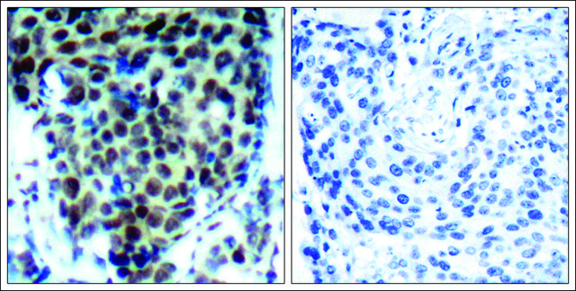 Anti-phospho-MAPK14 (pThr¹??) antibody produced in