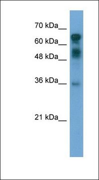 Anti-CXORF67 antibody produced in rabbit