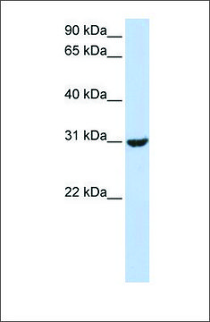 Anti-RNF182 (ab2) antibody produced in