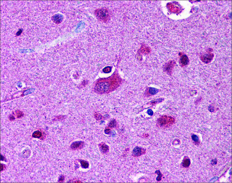 Anti-FKBP5 antibody produced in rabbit