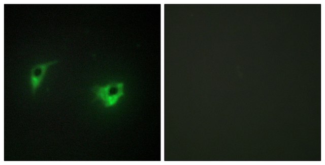 Anti-MEKKK 4 antibody produced in