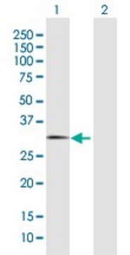 Anti-FBXO44 antibody produced in rabbit