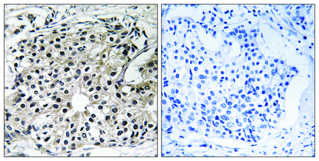 Anti-PECI antibody produced in rabbit