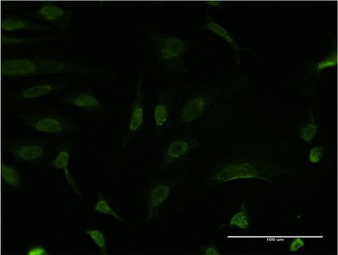 Monoclonal Anti-BCL9 antibody produced in