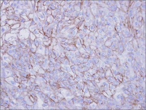 Anti-DSG2 (N-terminal) antibody produced in