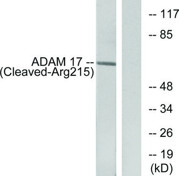 Anti-ADAM 17 (Cleaved-Arg²¹?) antibody produced