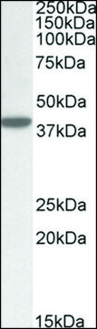 Anti-ERLIN1 (C-terminal) antibody produced in
