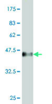 ANTI-SMAD4 antibody produced in mouse
