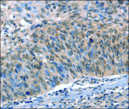 Anti-CAMTA1 antibody produced in rabbit