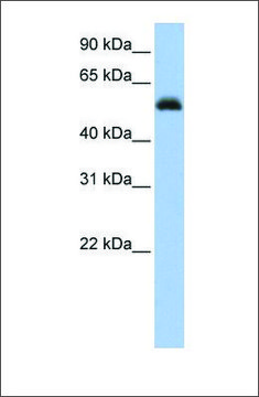 Anti-RUNX1 (ab2) antibody produced in