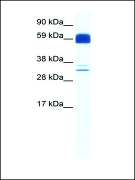 Anti-ZIC5 antibody produced in rabbit
