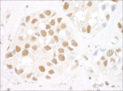 Rabbit anti-Ku80 Antibody, Affinity Purified