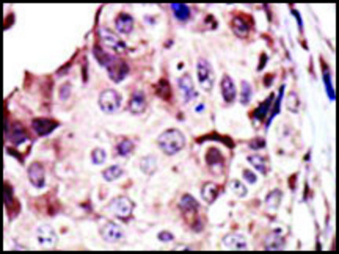 Anti-RYK antibody produced in rabbit