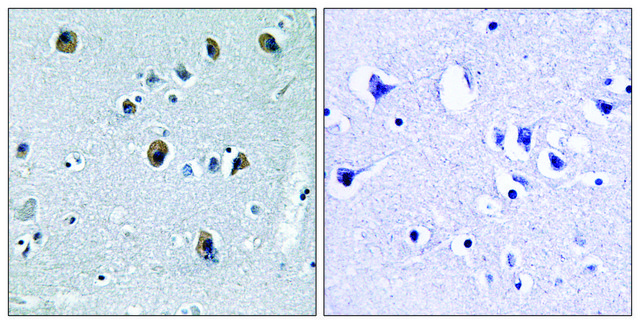 Anti-Collagen XX ?1 antibody produced