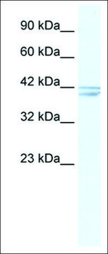 Anti-CHRNA7