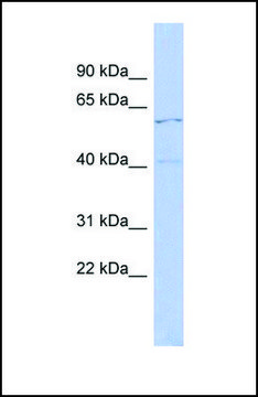 Anti-ZNF384 antibody produced in rabbit