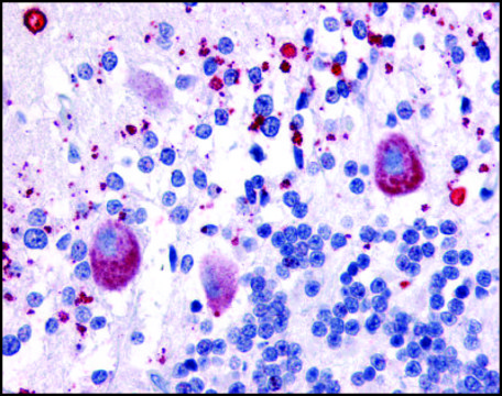 Anti-HTR7 (AB3) antibody produced in