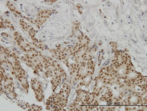 Monoclonal Anti-PGR antibody produced in