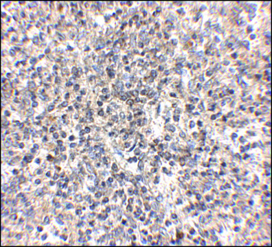 Anti-RSPO1 antibody produced in rabbit