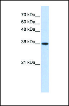 Anti-AKR7A3 antibody produced in rabbit