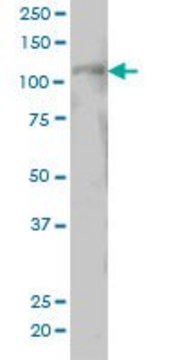 ANTI-PTK2 antibody produced in mouse