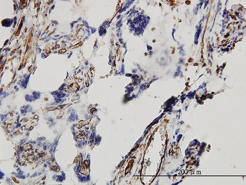 Monoclonal Anti-DKK1 antibody produced in