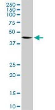 Anti-ELAC1 antibody produced in rabbit