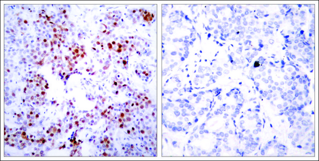 Anti-ATF2 (Ab-69 or 51) antibody