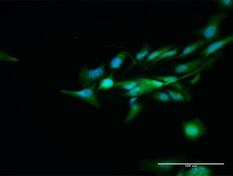 Anti-DCPS antibody produced in rabbit