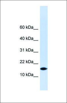 Anti-PHLDA3 antibody produced in rabbit