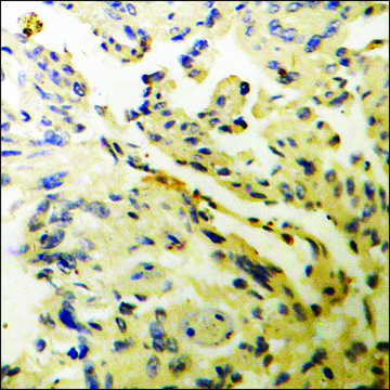 Anti-phospho-WNK1 (pThr??) antibody produced in