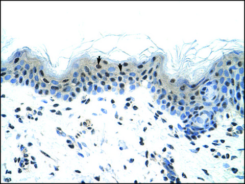 Anti-SCN5A antibody produced in rabbit