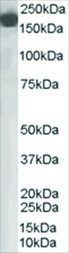 Anti-Complement Factor H antibody produced