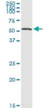 Anti-PCCB antibody produced in rabbit
