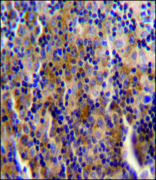 ANTI-SYNE3 (C-TERM) antibody produced in