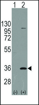 Anti-PARP16 (C-term) antibody produced in