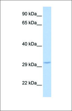 Anti-FBXO27 antibody produced in rabbit