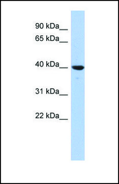 Anti-GLRX3, (N-terminal) antibody produced in