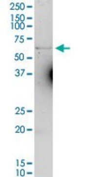 Anti-SLC40A1 antibody produced in rabbit