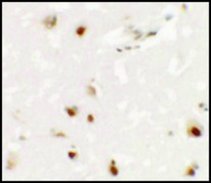 Anti-SHANK3 antibody produced in rabbit