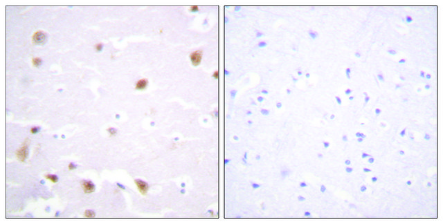 Anti-CKII-? antibody produced in rabbit