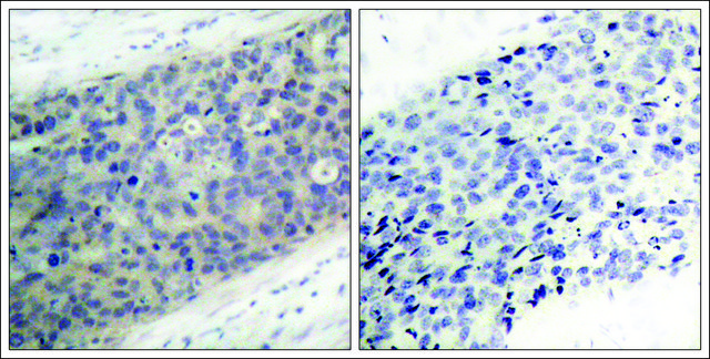 Anti-phospho-LIMK2 (pThr???) antibody produced in